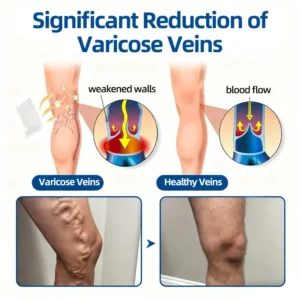 👩‍⚕️🎁 𝐅𝐥𝐨𝐫𝐢𝐬𝐦𝐚® ✅ 𝐕𝐞𝐢𝐧𝐓𝐚𝐫𝐠𝐞𝐭 𝐌𝐢𝐜𝐫𝐨𝐧𝐞𝐞𝐝𝐥𝐞 𝐏𝐚𝐭𝐜𝐡⚡Instant Relief, Long-Term Results