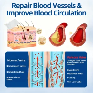 👩‍⚕️🎁 𝐅𝐥𝐨𝐫𝐢𝐬𝐦𝐚® ✅ 𝐕𝐞𝐢𝐧𝐓𝐚𝐫𝐠𝐞𝐭 𝐌𝐢𝐜𝐫𝐨𝐧𝐞𝐞𝐝𝐥𝐞 𝐏𝐚𝐭𝐜𝐡⚡Instant Relief, Long-Term Results