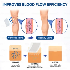 7-Day Visible Results✅𝑭𝑳𝑶𝑹𝑰𝑺𝑴𝑨® 𝐕𝐞𝐢𝐧 𝐂𝐨𝐧𝐭𝐨𝐮𝐫 𝑪𝒍𝒊𝒏𝒊𝒄𝒂𝒍-𝑮𝒓𝒂𝒅𝒆 𝑭𝒐𝒓𝒎𝒖𝒍𝒂 𝑴𝒊𝒄𝒓𝒐𝒏𝒆𝒆𝒅𝒍𝒆 𝑷𝒂𝒕𝒄𝒉(𝑫𝑰𝑶𝑺𝑴𝑰𝑵 & 𝑯𝑬𝑺𝑷𝑬𝑹𝑰𝑫𝑰𝑵)— 𝗔𝗱𝘃𝗮𝗻𝗰𝗲𝗱 𝗛𝗲𝗿𝗯𝗮𝗹 𝗕𝗹𝗲𝗻𝗱 𝗧𝗮𝗿𝗴𝗲𝘁𝘀 𝗦𝗽𝗶𝗱𝗲𝗿 𝗩𝗲𝗶𝗻𝘀 & 𝗥𝗲𝗹𝗶𝗲𝘃𝗲𝘀 𝗛𝗲𝗮𝘃𝘆, 𝗧𝗶𝗿𝗲𝗱 𝗟𝗲𝗴𝘀🚀